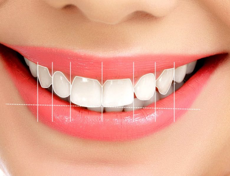 Dental İmplant Kullanmanın Avantajları Nelerdir?   